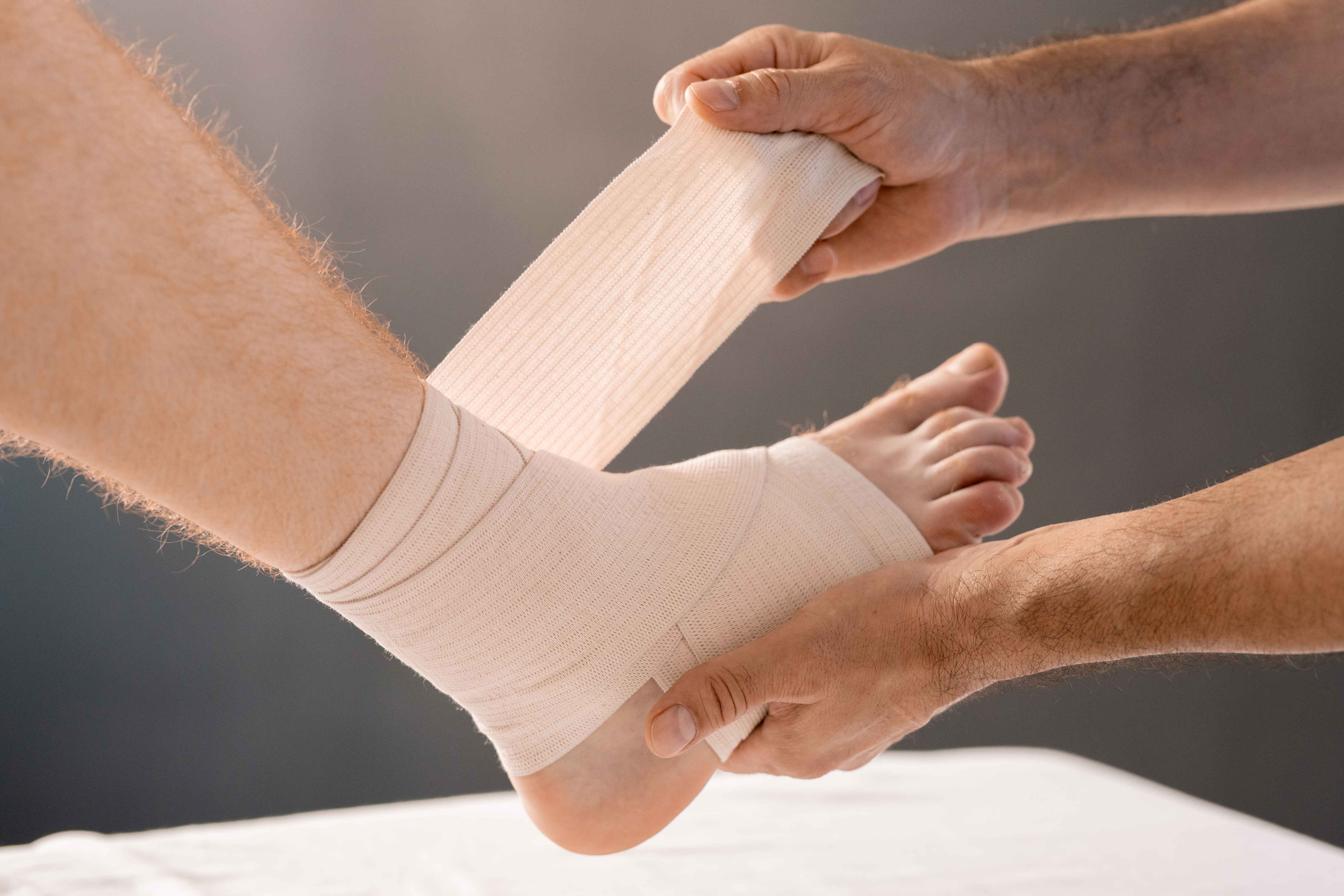 Speedy Recovery: Healing a Sprained Ankle Quickly